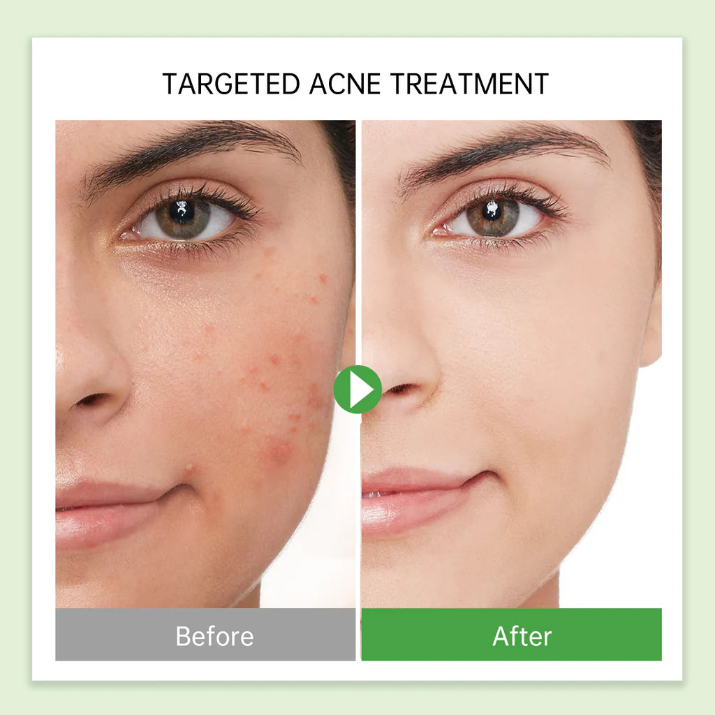 Tea Tree Refreshing Facial Cleanser