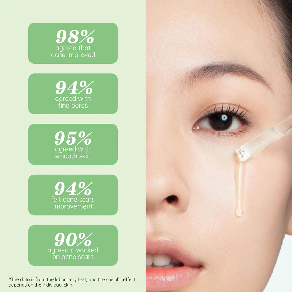 Jelly Prim Tea Tree Acne Treatment Serum