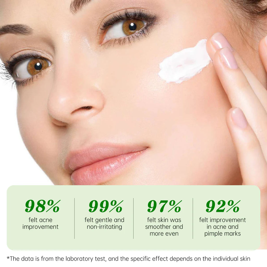 Jelly Prim Tea Tree Essence Acne Recovery Cream