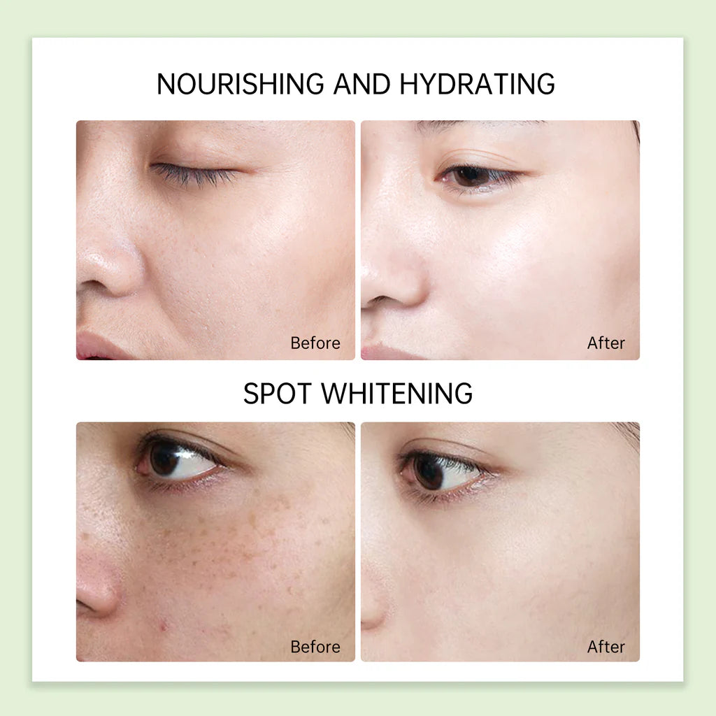 Tea Tree Essence Acne Recovery Cream