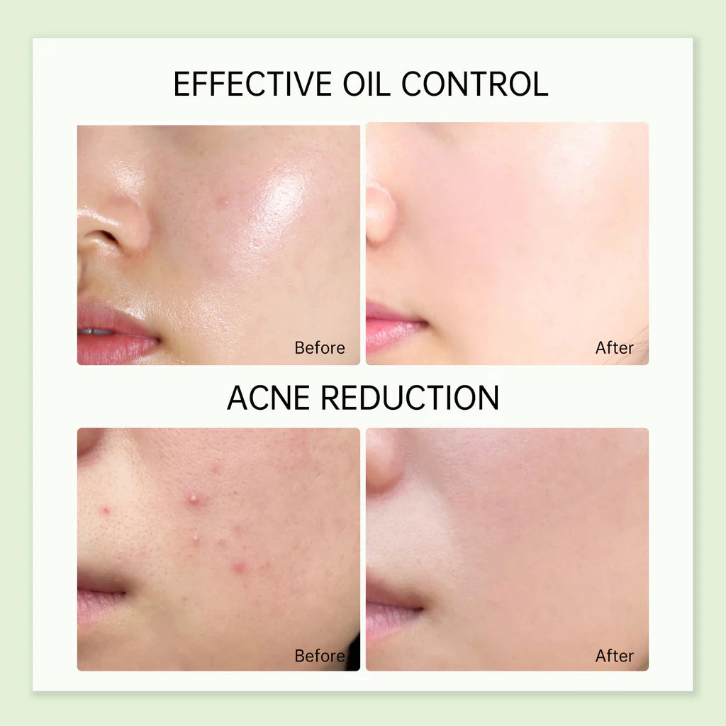 Tea Tree Refreshing Toner