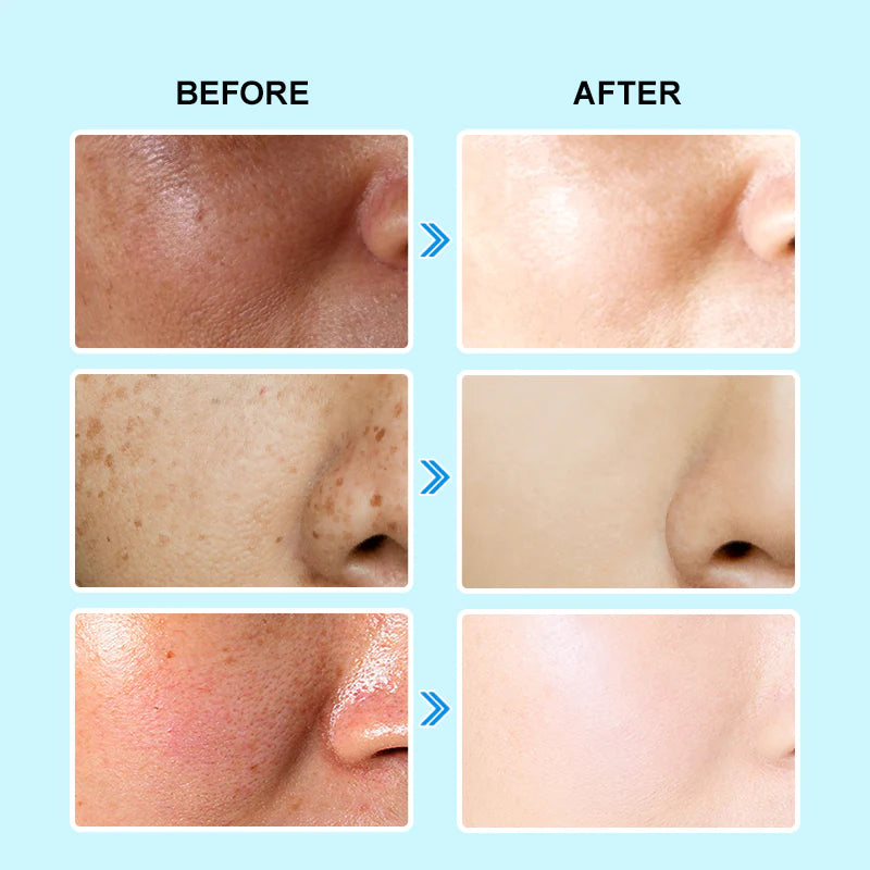 3 In 1 Oil-Control And Brightening Serum