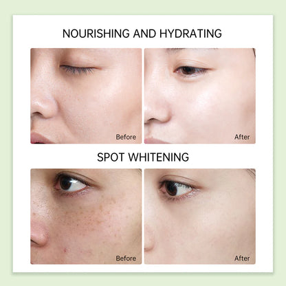 Jelly Prim Tea Tree Essence Acne Recovery Cream